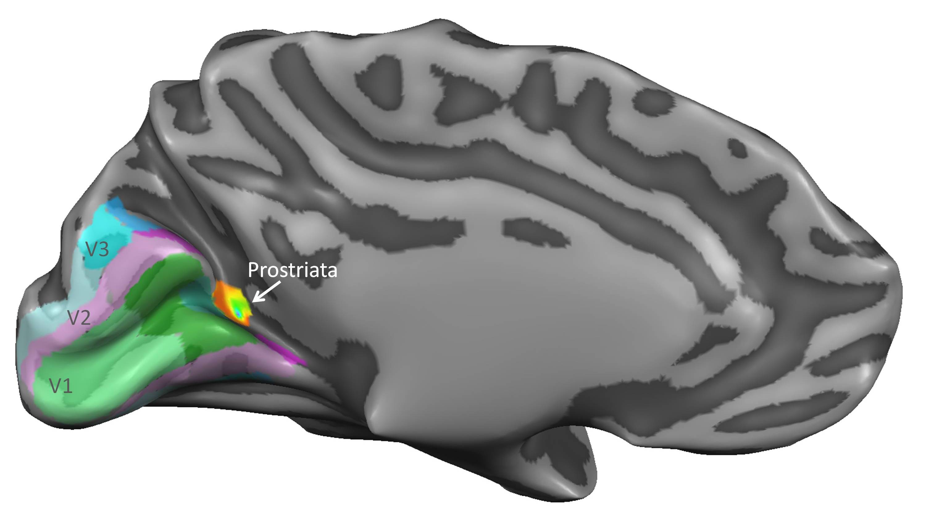 Brain_Prostriata_copy.jpg