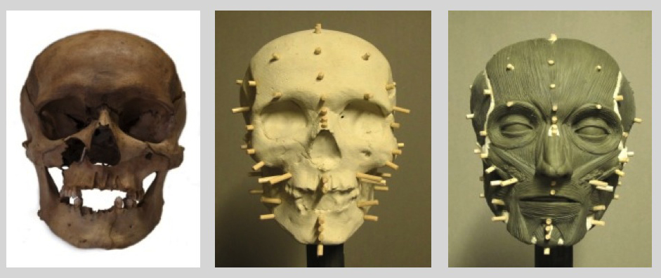 cranio EnricoVII