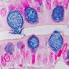 The Gut barrier: a novel frontier in digestive and extra-digestive diseases